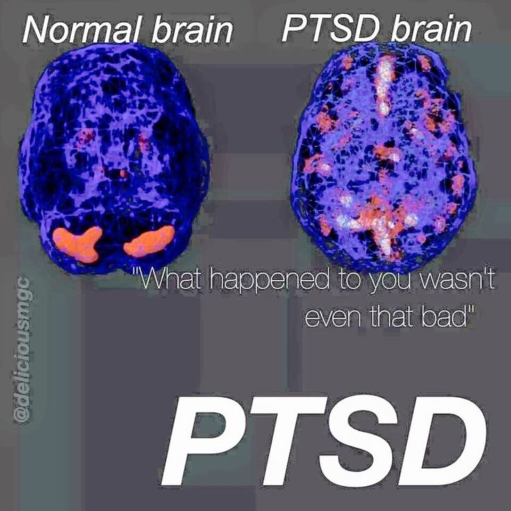 pinky the porn star nakeded dating site for ptsd