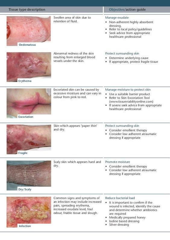 411 best nursing images on Pinterest Nursing schools, Nurses and - wound ostomy continence nurse sample resume 411 best nursing images on Pinterest Nursing schools, Nurses and - wound ostomy continence nurse sample resume