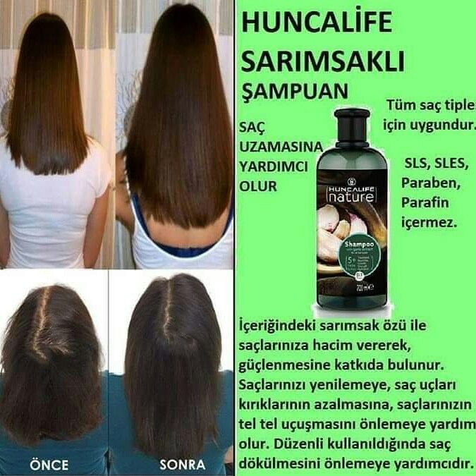 Sac Uzamasina Ve Dokulmesi Yardimci Olur Kepek Olusumunu Engeller Parafin Sac Sampuan Sac Uzamasina Ve Dokulmesi Yardimci Olur Kepek Olusumunu Engeller Parafin Sac Sampuan