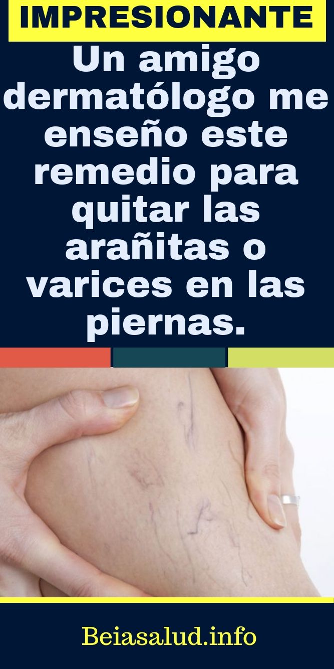 Pin On Remedios Caseros