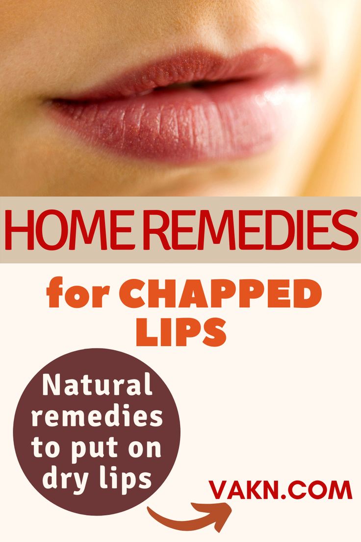 Pin in the region of Best estate Remedies that essentially take steps Fast