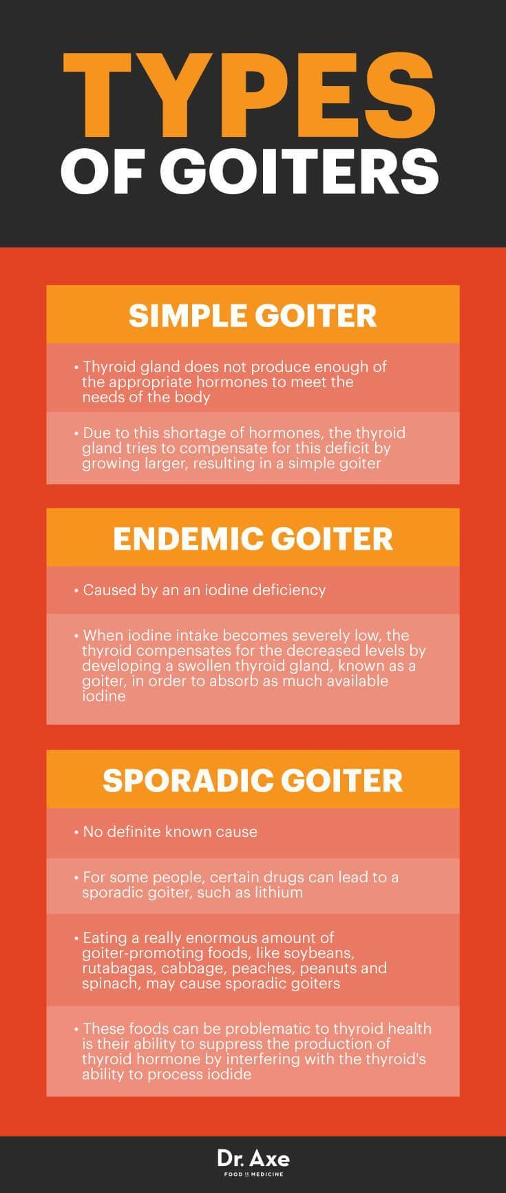 Goiter is endemic, symptoms and treatment 87 Goiter is endemic, symptoms and treatment 23