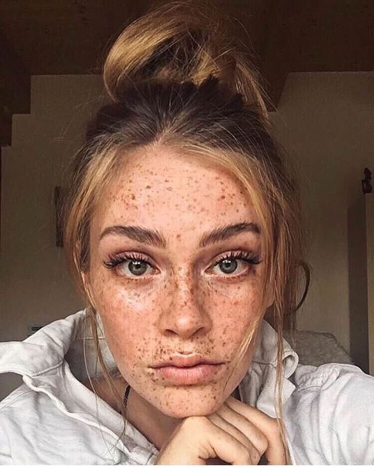 Sport drunk messy freckles