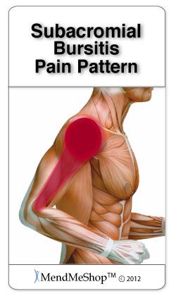 frozen shoulder hot compress subacromial bursitis pain pattern massage therapy frozen shoulder hot compress subacromial bursitis pain pattern massage therapy