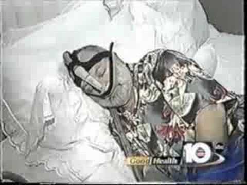 Sleep Apnea Center West Palm Beach Sleep Apnea Center West Palm Beach