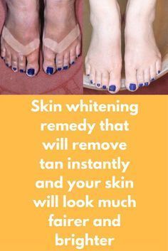 Skin whitening remedy that will remove tan instantly and your skin will look much fairer and brighter