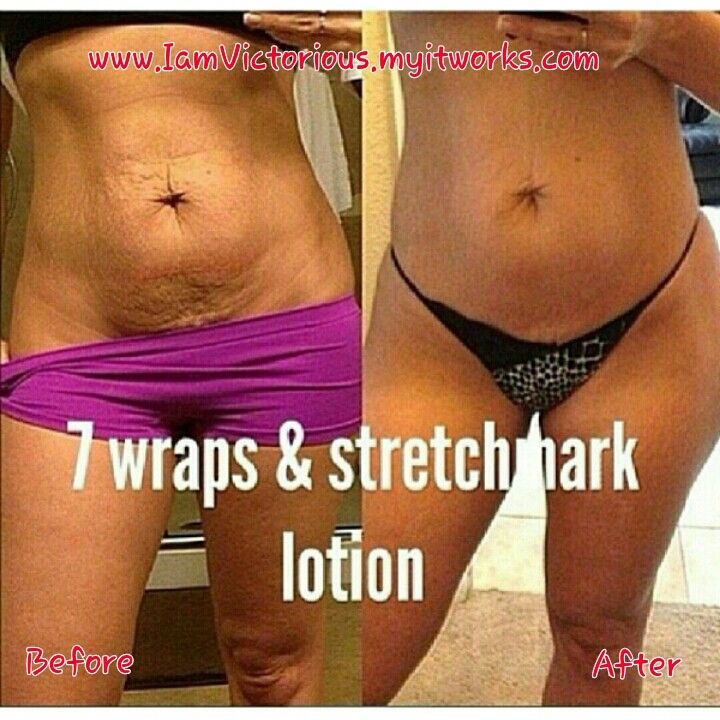Celexa weight loss after stopping zoloft Also celexa weight loss after stopping zoloft