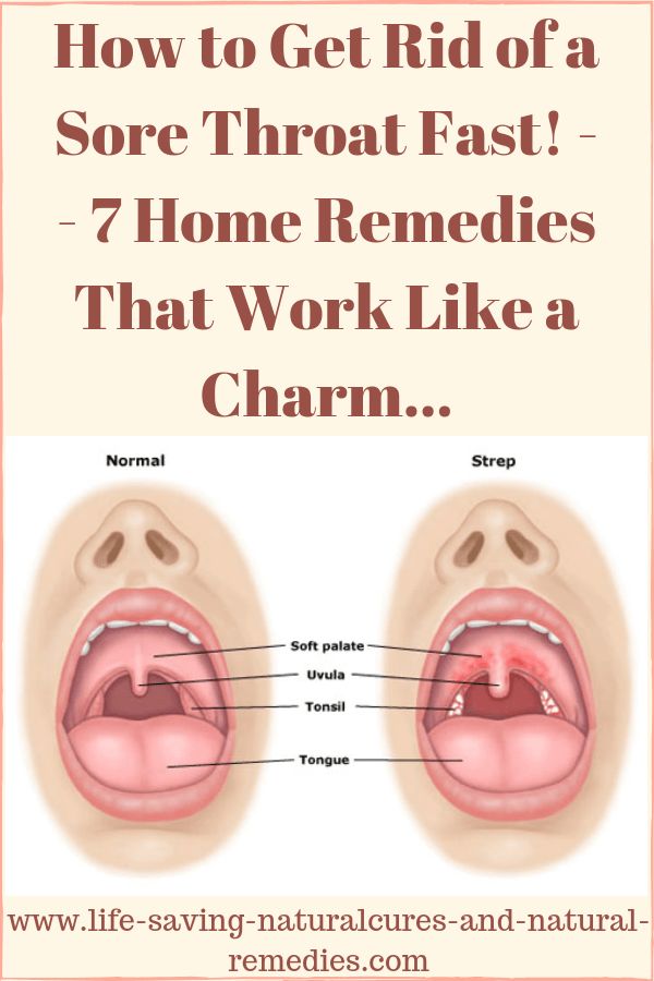 pin on natural home remedies