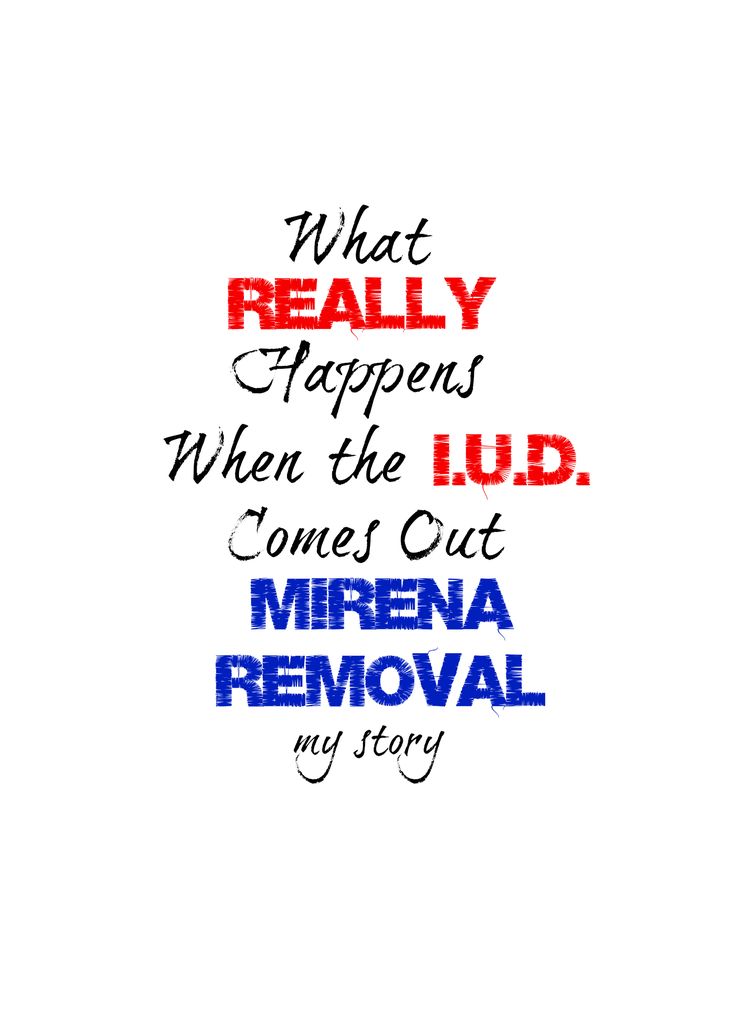 Levonorgestrel Side Effects Mirena