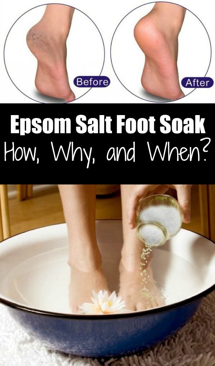 Epsom salt is derived from distilled, mineralrich water Epsom salt is derived from distilled, mineralrich water
