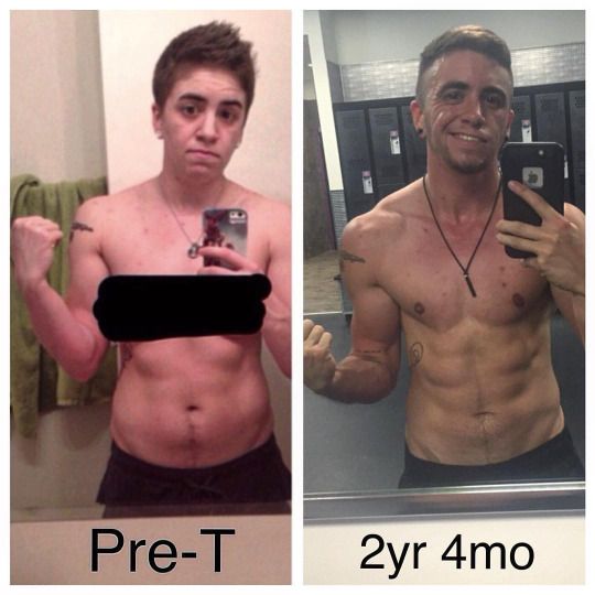 requirements male breast transgender Requirements male breast transgender