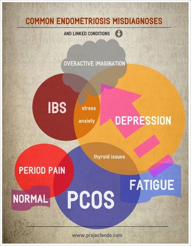 Polycystic ovaries painful periods