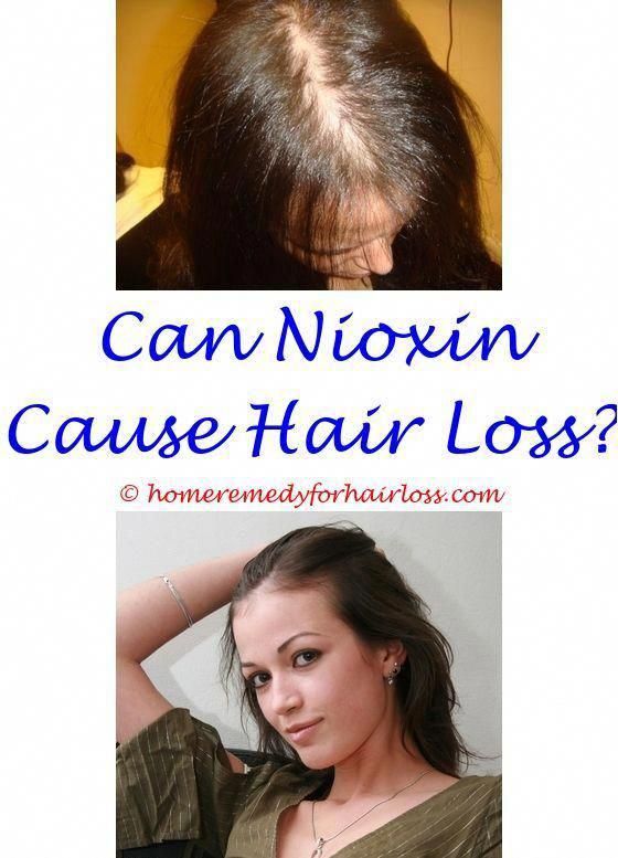 Mam Fack Son Natural ways to get rid of hair fall