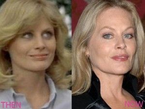 Beverly D’Angelo | Beverly d'angelo, Celebrity plastic surgery, Celebrities