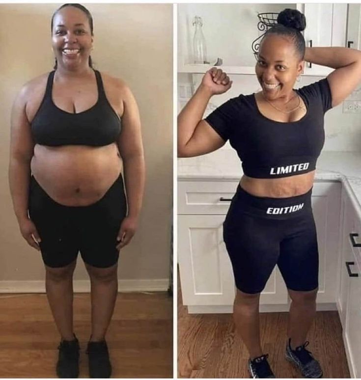 liquid lipo chin liquid lipo chin