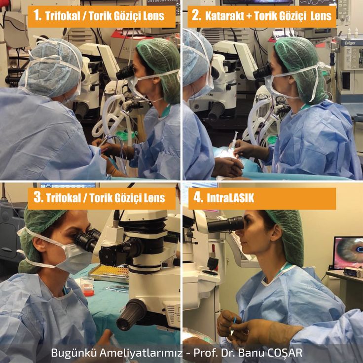 Cok Gelisen Gozici Lens Tasarimlari Sayesinde Artik Katarakt Ameliyati Sonrasi Uzak Gozlugune De Yakin Gozlugune De Gerek Kalmiyor Bilgi Tasarim Cok Gelisen Gozici Lens Tasarimlari Sayesinde Artik Katarakt Ameliyati Sonrasi Uzak Gozlugune De Yakin Gozlugune De Gerek Kalmiyor Bilgi Tasarim