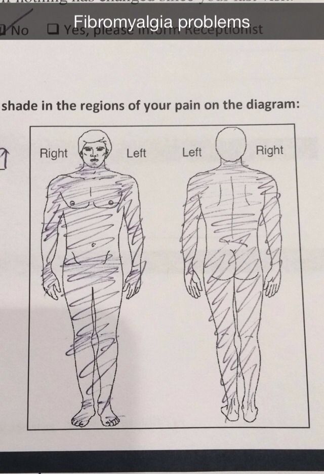 338 best invisible illnesses images on pinterest chronic pain 1b412e931bd30101b17c6c0deb7a38da chronic illness endometriosis 338 best invisible illnesses images on pinterest chronic pain,Positive Chronic Illness Memes