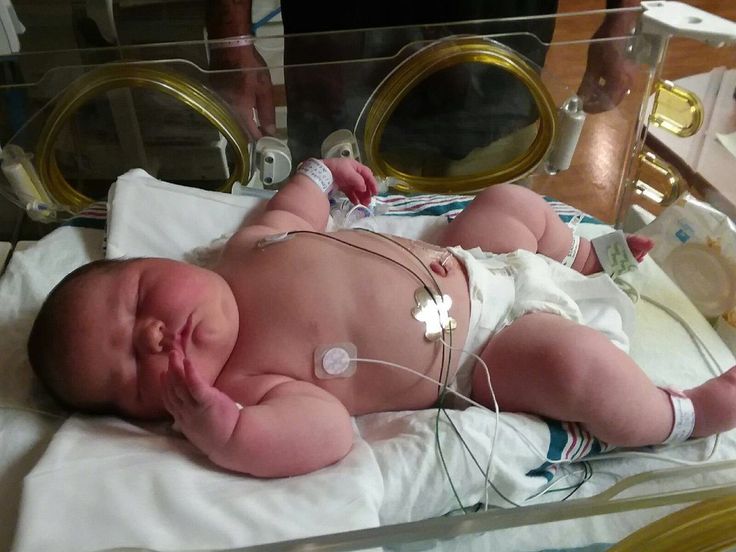Mom Gives Birth To Biggest Baby Doctors Have Ever Seen And Says She s mom-gives-birth-to-biggest-baby-doctors-have-ever-seen-and-says-she-s