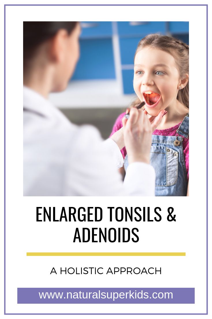 home remedies for enlarged tonsils