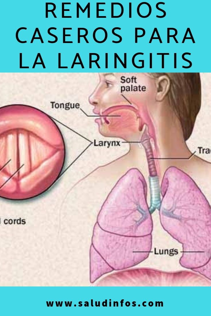 Remedios naturales para laringitis en ninos