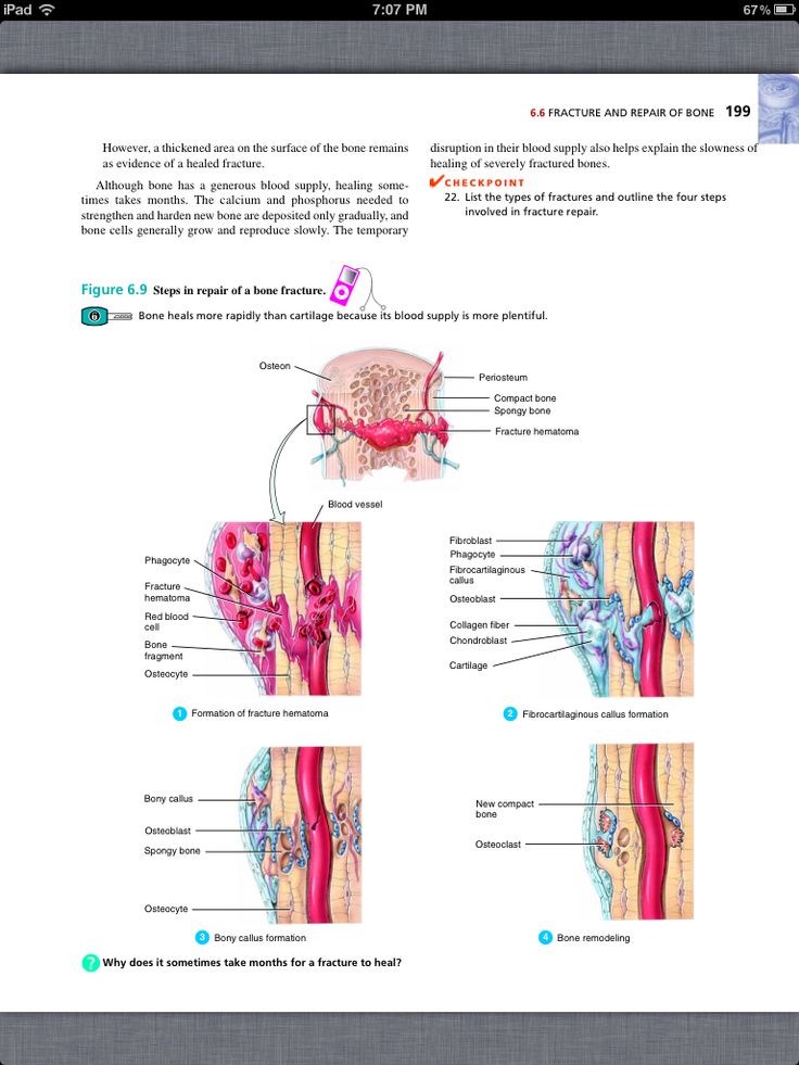 chapter 6 bone tissue Outer fibrous layer is dense connective tissue inner osteogenic layer (next to bone surface) is mostly osteoblasts chapter 6 bones and skeletal tissues. chapter 6 bone tissue Outer fibrous layer is dense connective tissue inner osteogenic layer (next to bone surface) is mostly osteoblasts chapter 6 bones and skeletal tissues.
