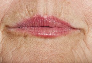 Comment atténuer les rides autour de la bouche
