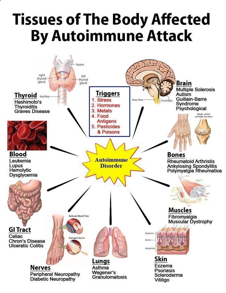 is psoriasis an autoimmune disorder