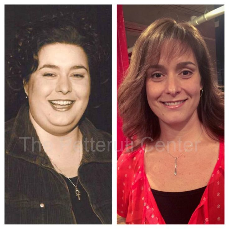 Can thyroid medication help you lose weight picture 4