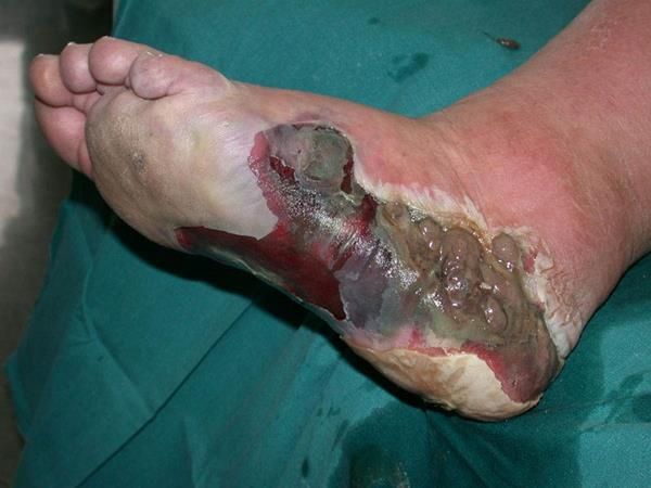 What Does Dog Antibiotics Treat What Does Dog Antibiotics Treat