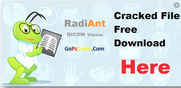 radiant dicom viewer review radiant dicom viewer review