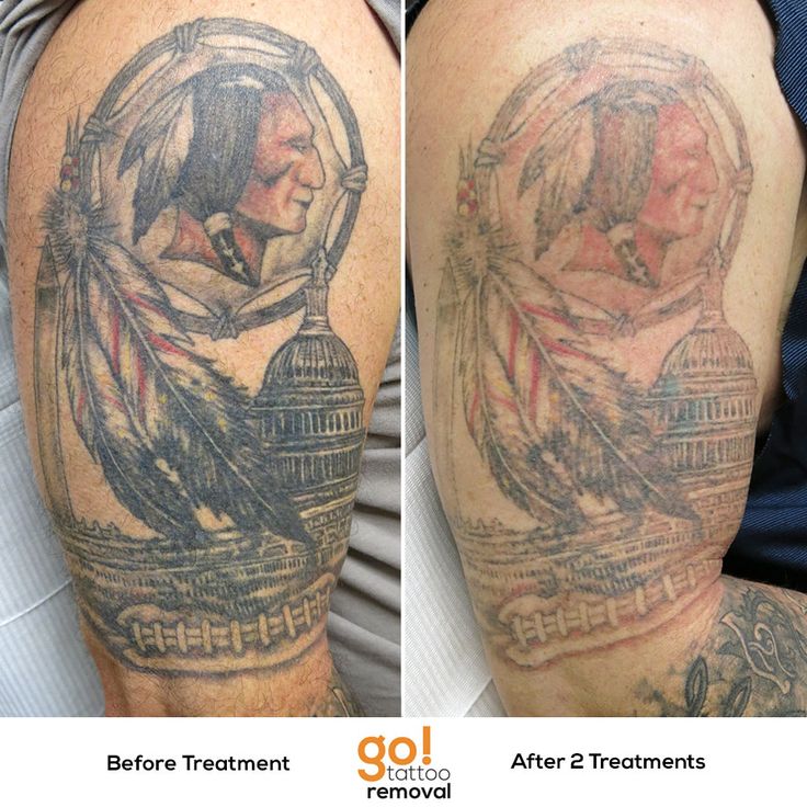 the 25 best half sleeve tattoo removed ideas on pinterest half the 25 best half sleeve tattoo removed ideas on pinterest half