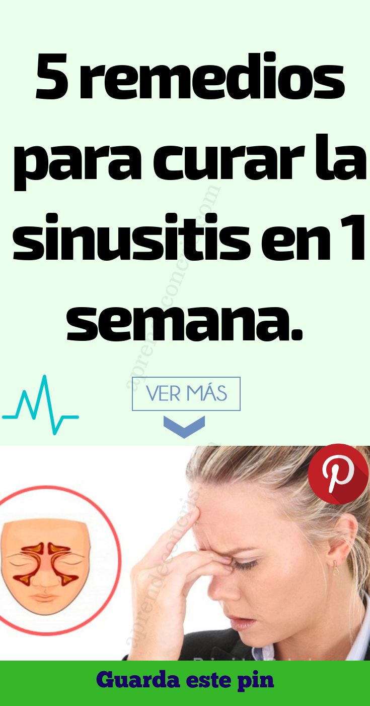 Semanas 2 Sinusitis Semanas 2 Sinusitis