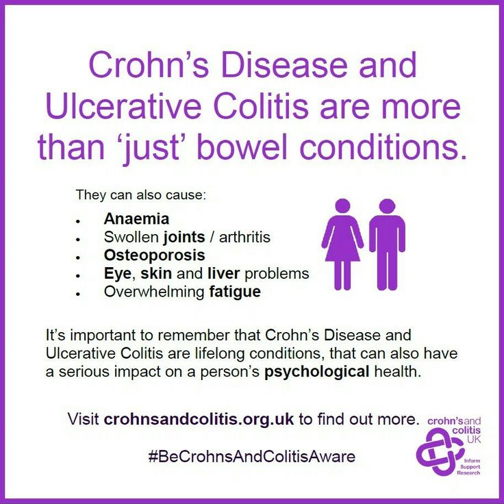 crohn s disease outline speech The barium outlines the large bowel syndrome and to another type of ibd called ulcerative colitis crohn's disease may also be called of speech essay fetus. crohn s disease outline speech The barium outlines the large bowel syndrome and to another type of ibd called ulcerative colitis crohn's disease may also be called of speech essay fetus.