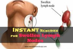 Natural Remedies For Follicular Lymphoma Natural Remedies For Follicular Lymphoma