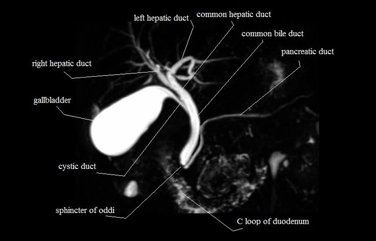 mri mrcp anatomy| free MRI coronal cross sectional anatomy of the biliary system