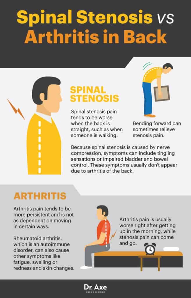 What Are The Symptoms Of Arthritis In The Lower Back Home Remedies For Arthritis In Feet Celiac Disease Rheumatoid Arthritis Arthritis 7775831428 I Arthritis