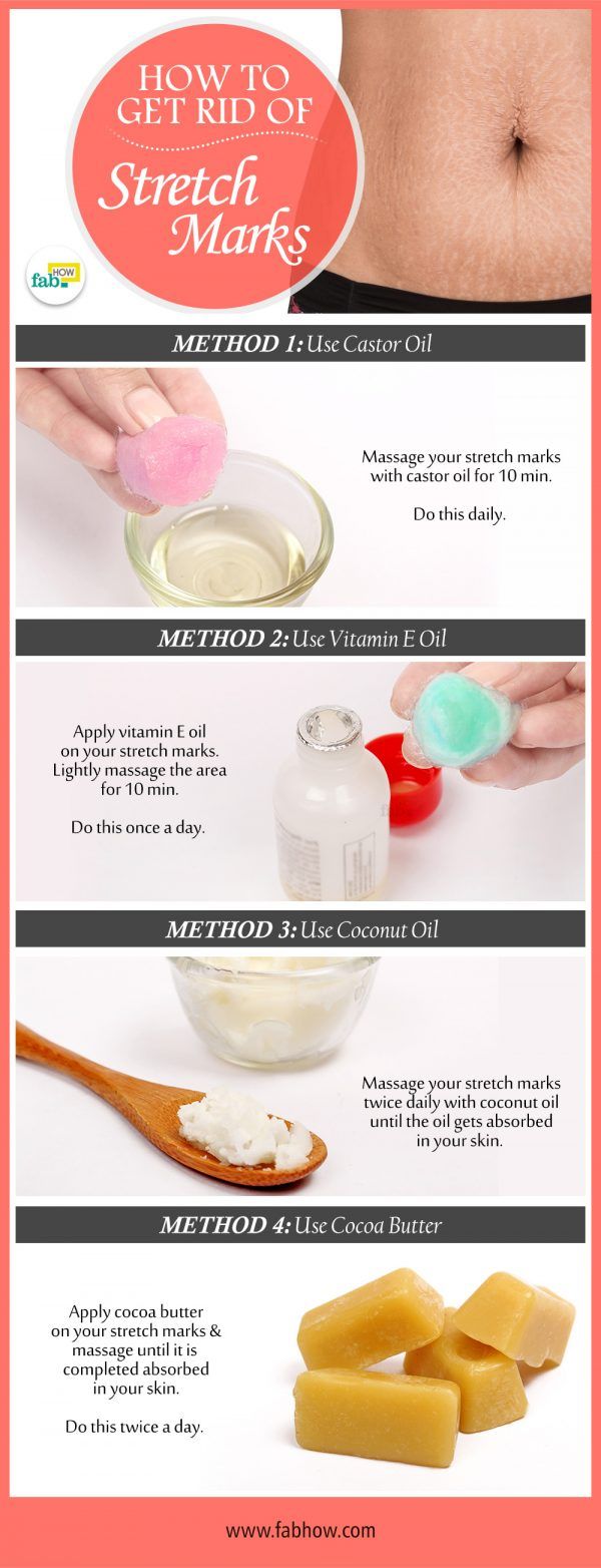 best 25 stretch marks ideas on pinterest face marks remover best 25 stretch marks ideas on pinterest face marks remover