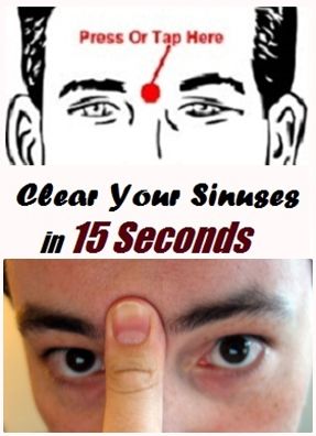 Clear Your Sinuses in 15 Seconds by pressing  Health 