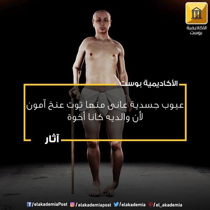 عيوب جسدية عانى منها توت عنخ آمون لأن والديه كانا أخوة لم يكن وجه وجسم الملك توت عنخ آمون مثاليا كما صوره لنا القناع الذهبي والرس Mood Arabic Quotes Poster