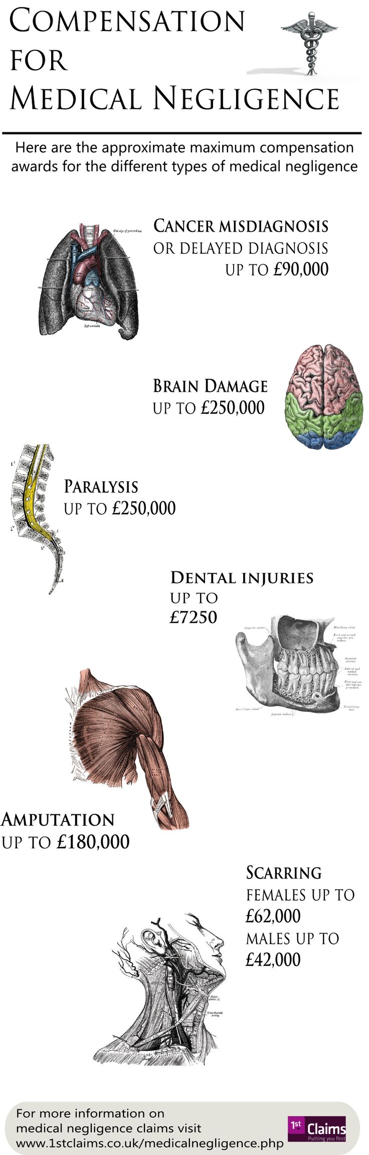 Medical negligence essay