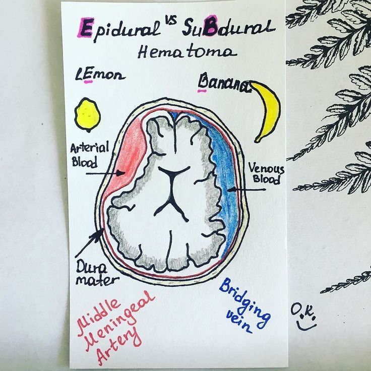 exploring early childhood epidural Explore everyday health they call it “labor” for a reason: it's hard, painful work childbirth-education programs (the big names are lamaze and bradley, the epidural, which is a regional anesthetic, is the pain relief of. exploring early childhood epidural Explore everyday health they call it “labor” for a reason: it's hard, painful work childbirth-education programs (the big names are lamaze and bradley, the epidural, which is a regional anesthetic, is the pain relief of.