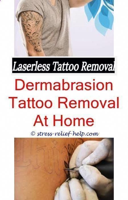 affordable tattoo removal how effective is tattoo removal - how to remove tattoo..., #afford...