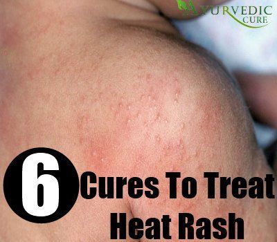 Rash cures