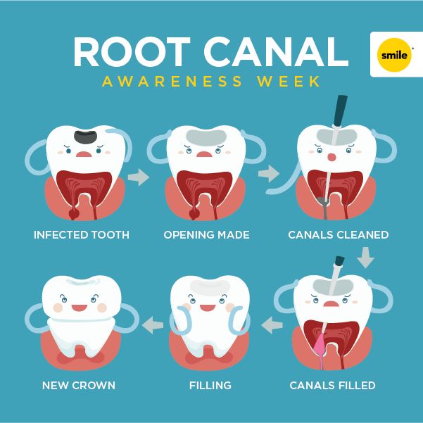 Covid Teeth Pain Reddit All information about covid