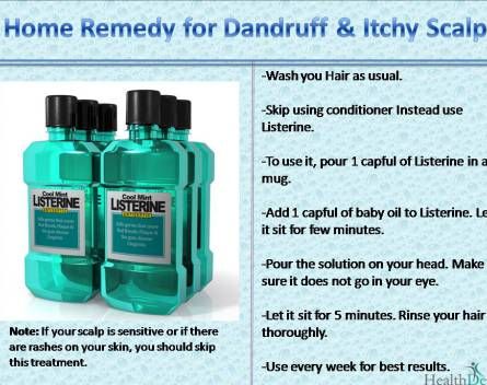 Natural Home Remedies For Really Itchy Scalp Natural Home Remedies For Really Itchy Scalp