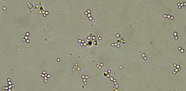 yeast Fluconazole and anal yeast Fluconazole and anal