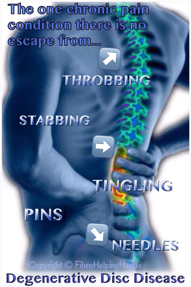 Degenerative Disc Disease Natural Cure Degenerative Disc Disease Natural Cure