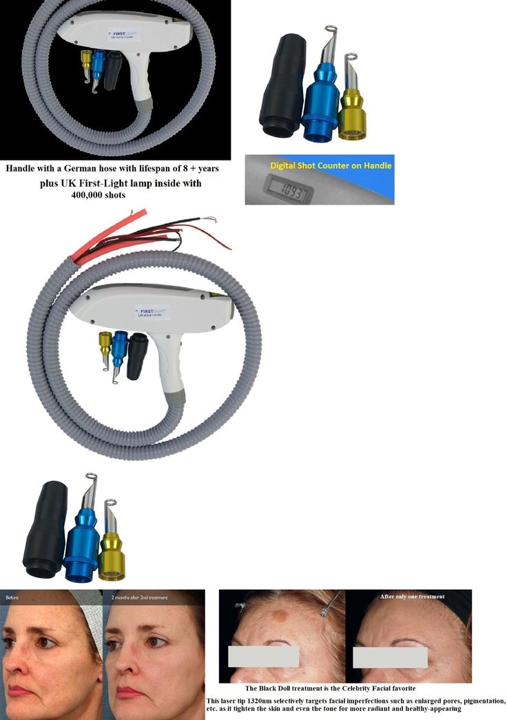 best 25 nd yag laser ideas on pinterest yag laser hair laser best 25 nd yag laser ideas on pinterest yag laser hair laser