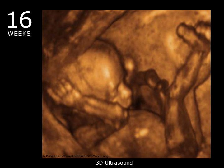 Week pregnancy dating scan what will it tell me - MadeForMums