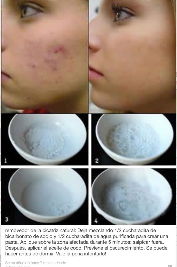 10 usos brillantes del Vicks VapoRub que te harán salir corriendo a buscarlo 10 usos brillantes del Vicks VapoRub que te harán salir corriendo a buscarlo